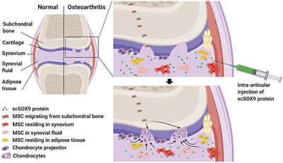 Exploiting Joint-Resident Stem Cells by Exogenous SOX9 for Cartilage Regeneration for Therapy of Osteoarthritis